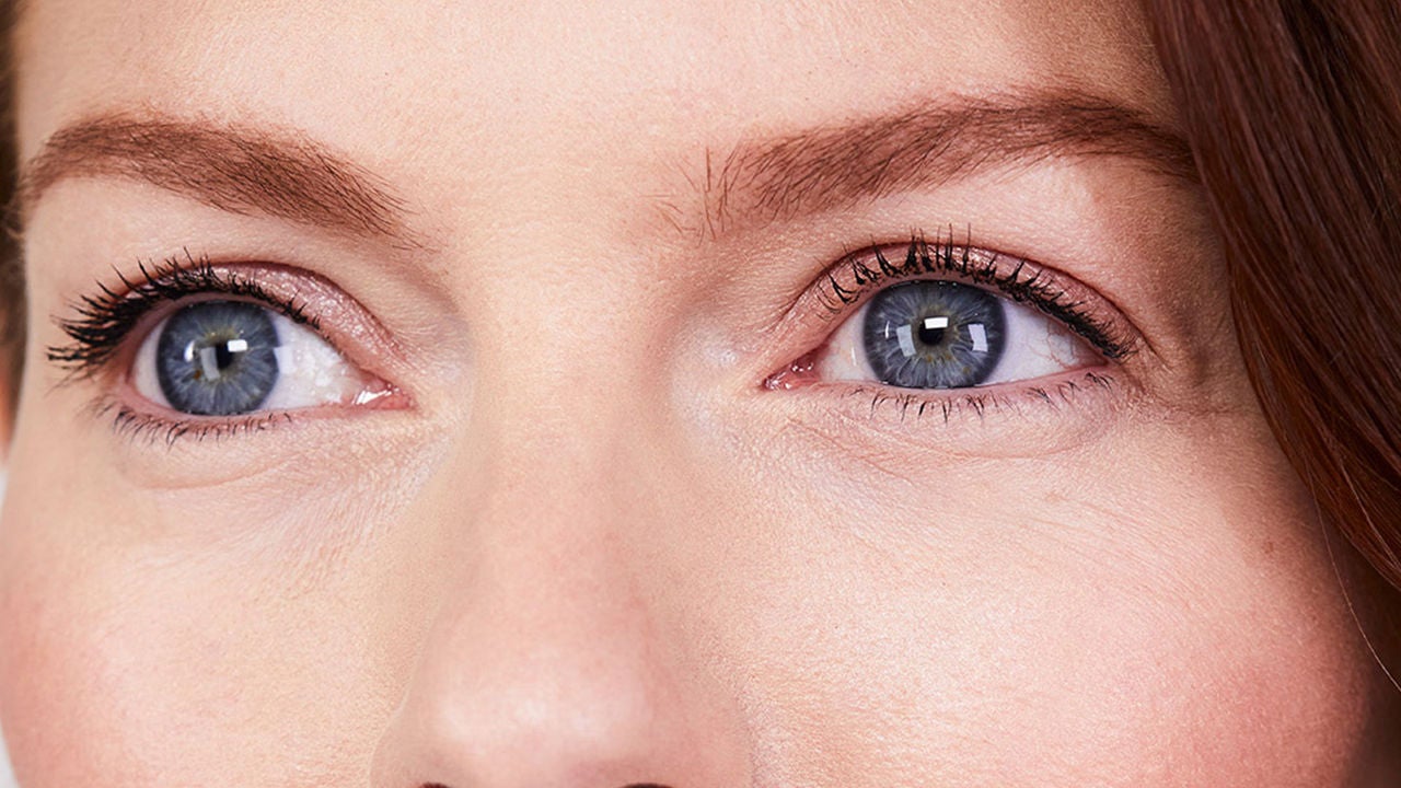 Yeux de femme après injections acide hyaluronique yeux et rides de Juvederm anti age